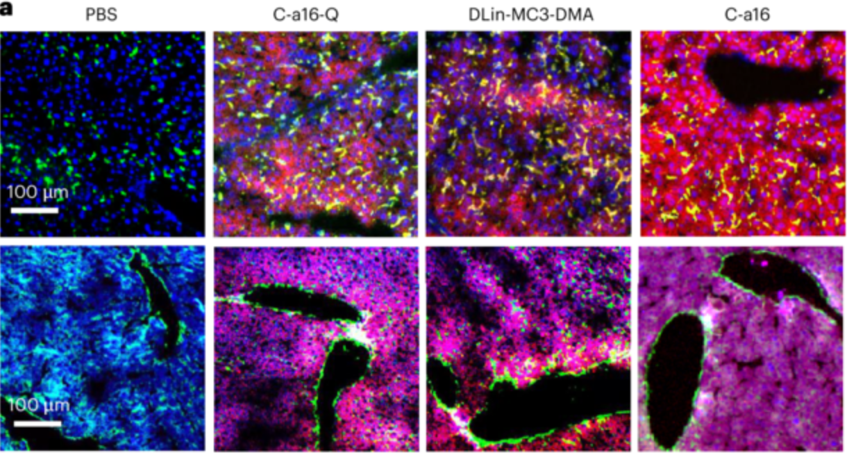 Liver Kupffer cells and endothelial cells were labelled with F4/80 and CD31 antibodies, respectively (green, upper panels for F4/80, lower panels for CD31). 