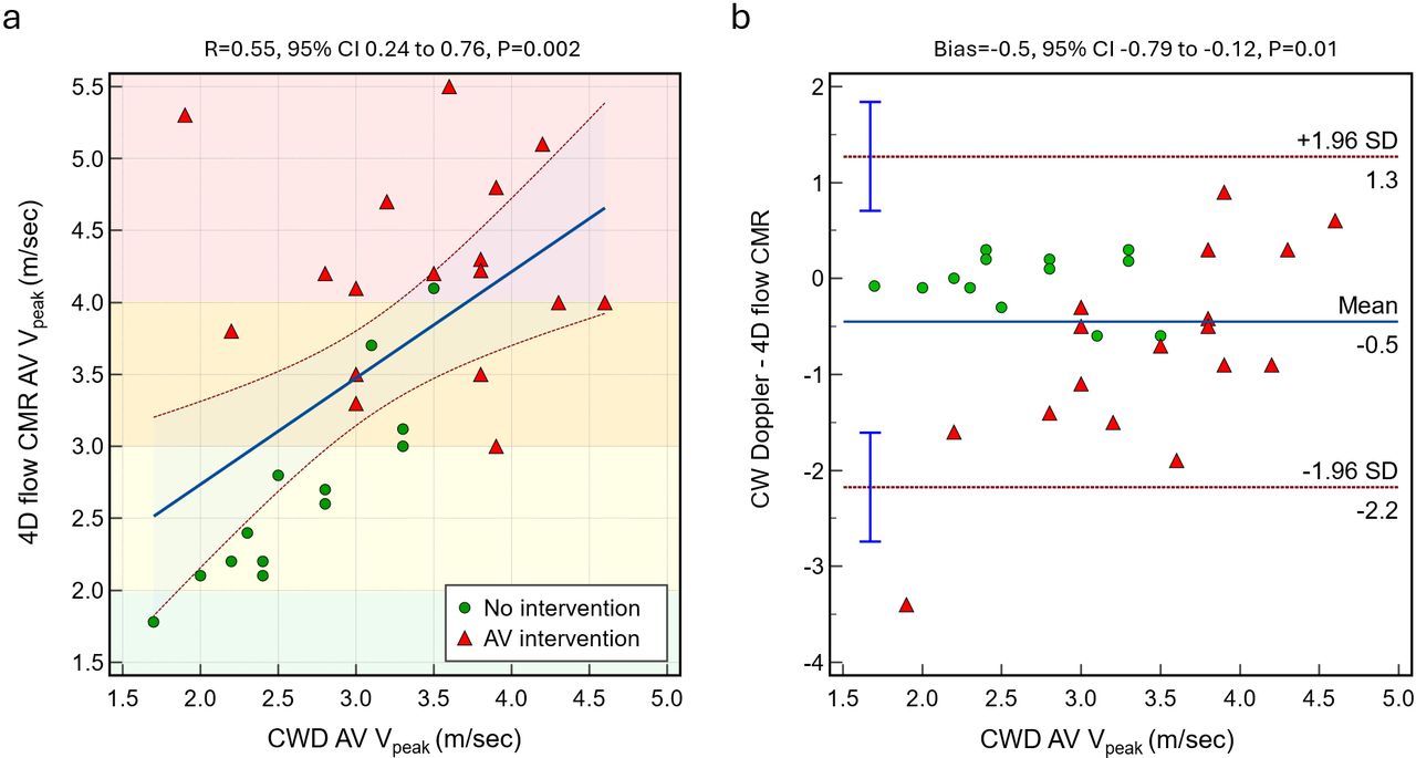 (a) Scatterplot between CWD and 4D flow CMR AV. (b) Bland-Altman plot shows a significant bias between methods.