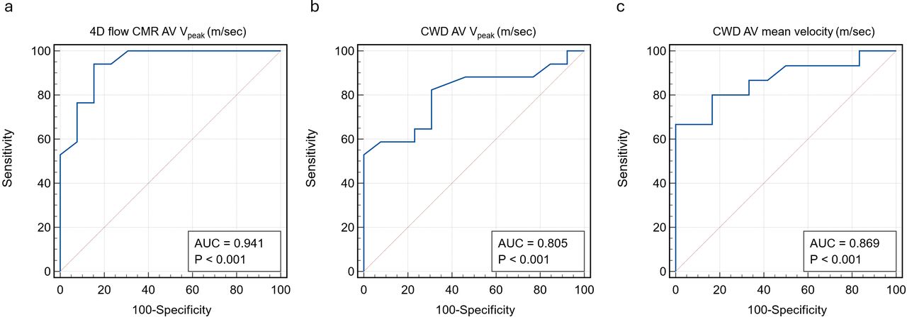 Receiver operating characteristic curves for predicting AV intervention based on 4D flow AV