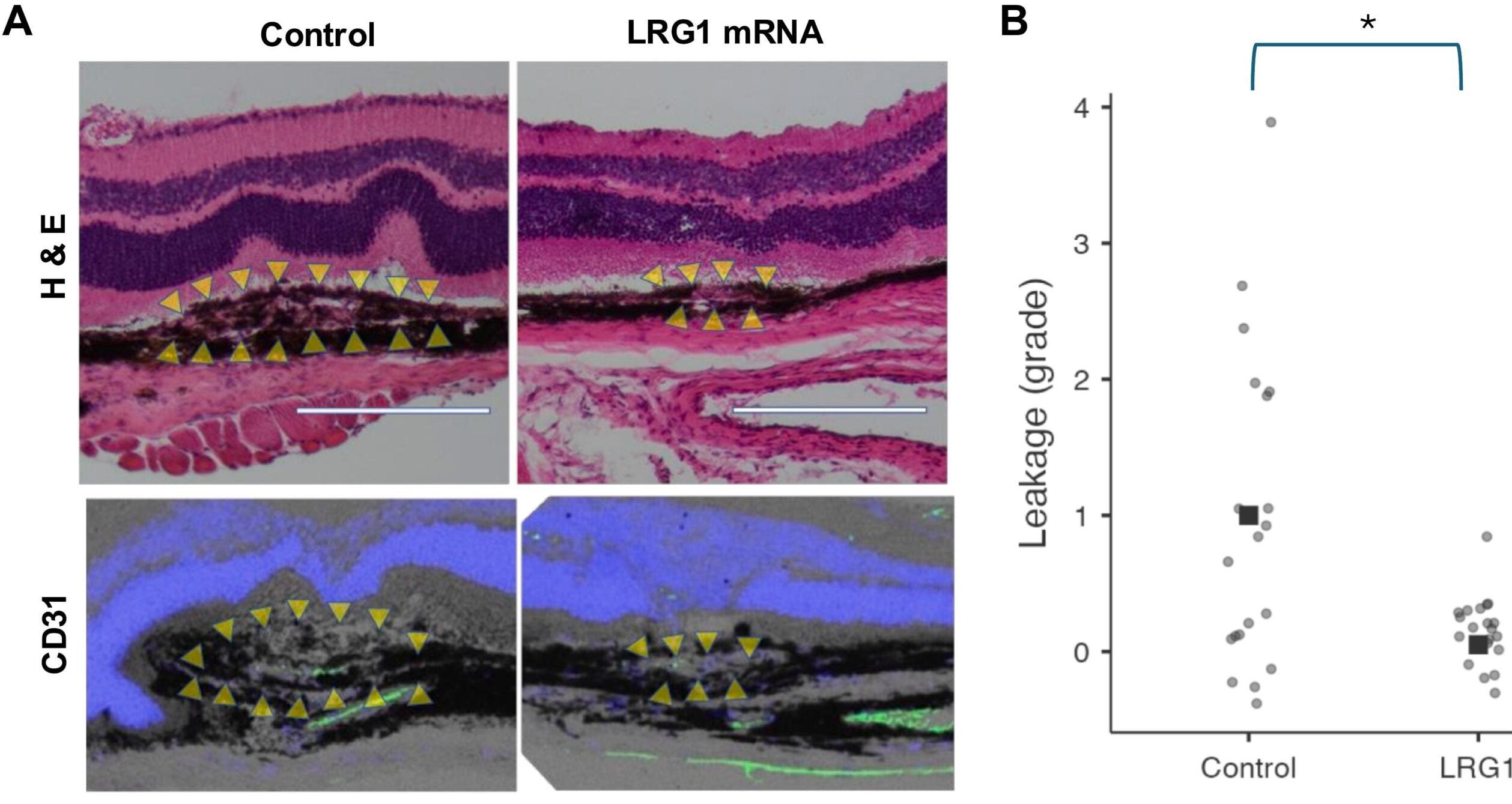Effects of LRG-1 mRNA vaccination on laser-induced CNV.