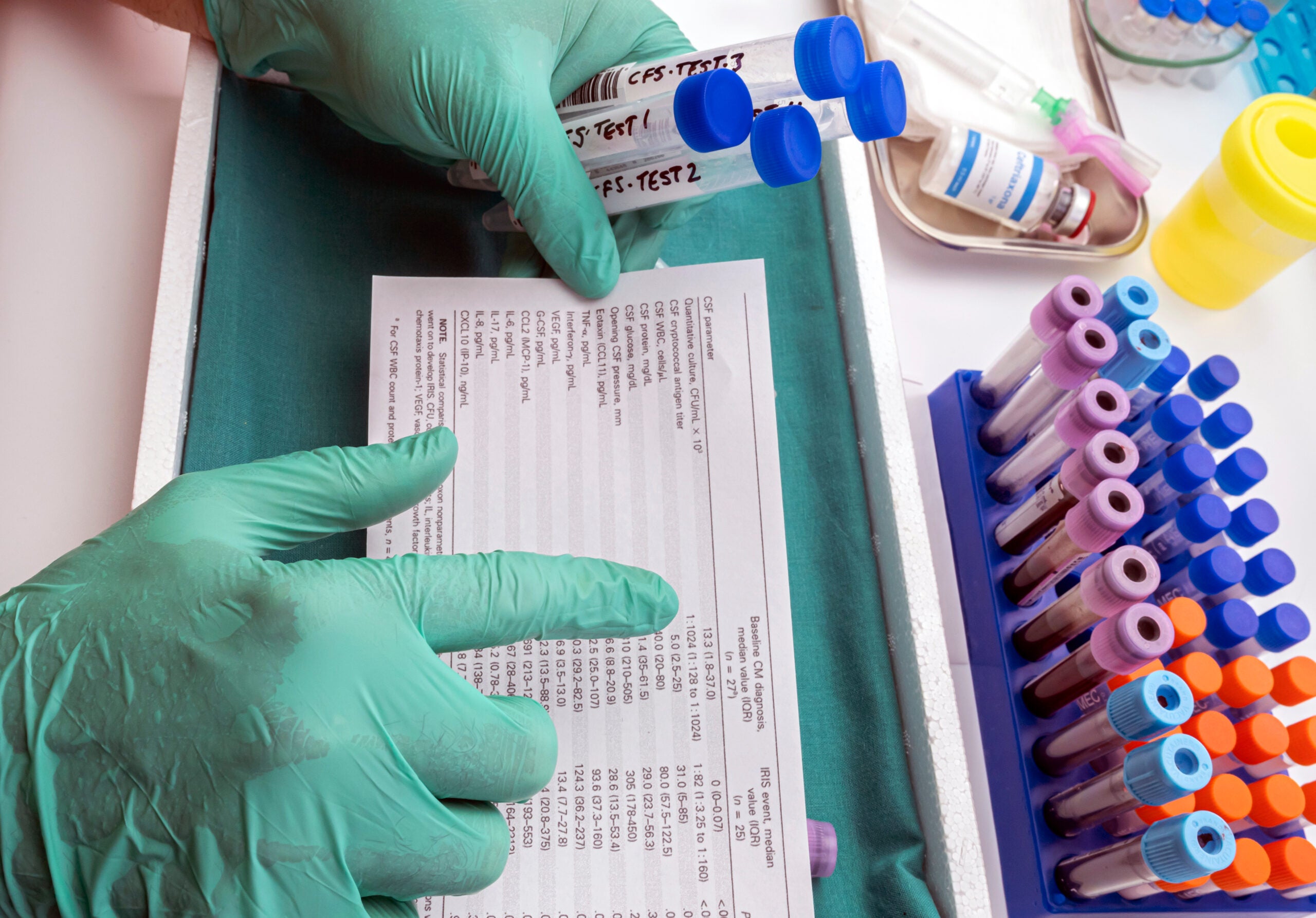 The new brain cancer test showed over 80% sensitivity and perfect specificity, offering safer answers without invasive biopsies.