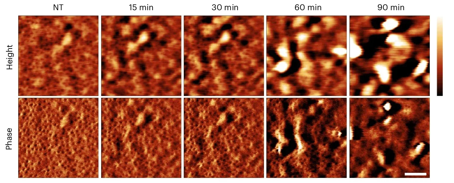 PmB-mediated OM disruption results in LPS loss without detectable disruption of the porin network.