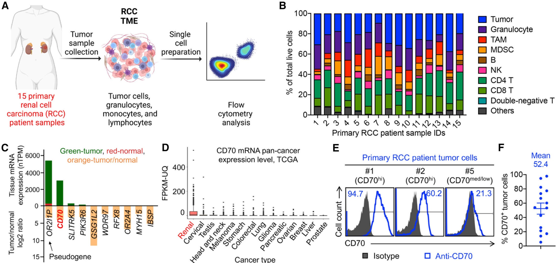 Biomarker profiling of primary RCC patient samples reveals therapeutic potential for CAR-NKT cell treatment