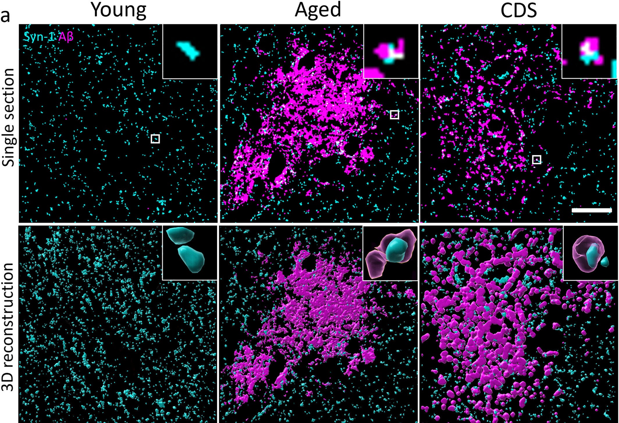 Amyloid-beta colocalises with synapses in the aged and cognitive dysfunction syndrome (CDS)-affected feline parietal cortex.