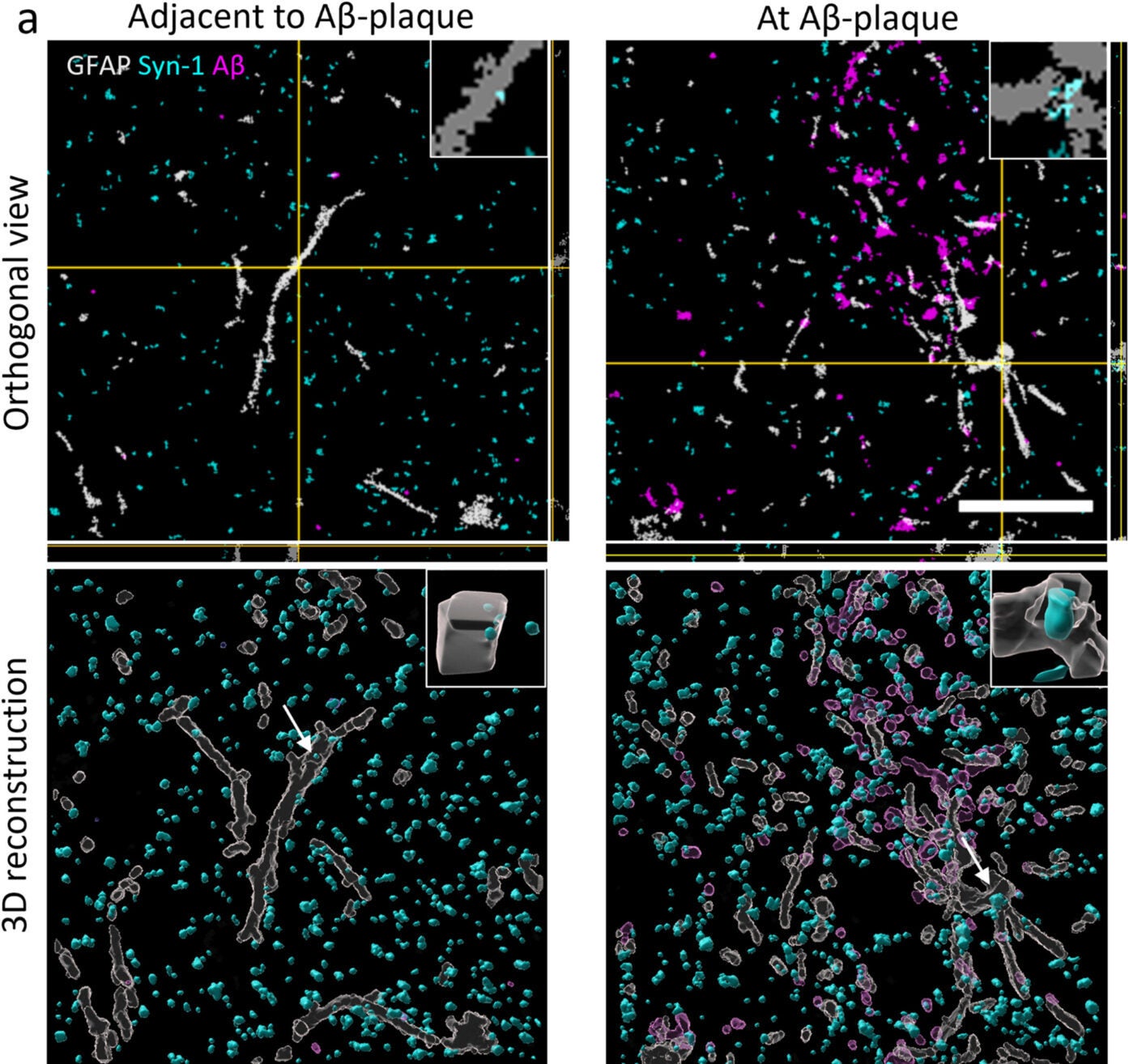 Amyloid-beta pathology induces increased synaptic engulfment by astrocytes in the feline brain.