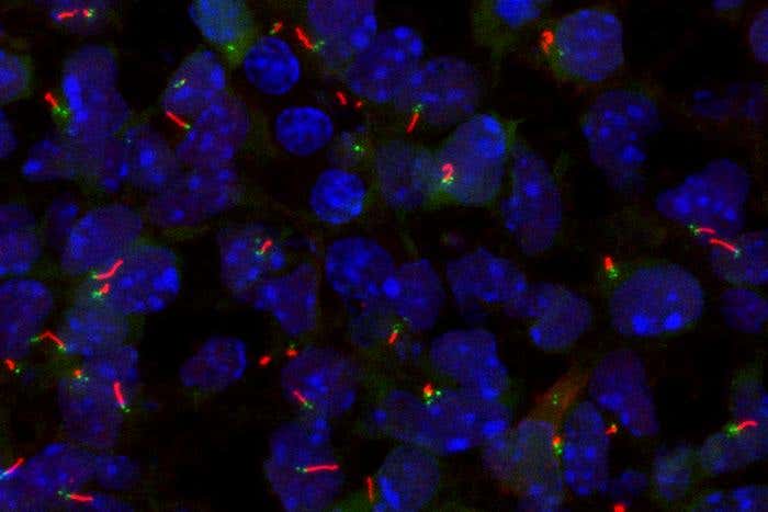 A new MSK study finds that two genes, SP5 and SP8, act as master switches for forming primary cilia — crucial structures in early development.