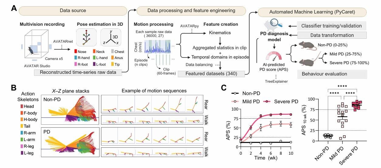 AI-based diagnosis and severity assessment of Parkinson’s disease 
