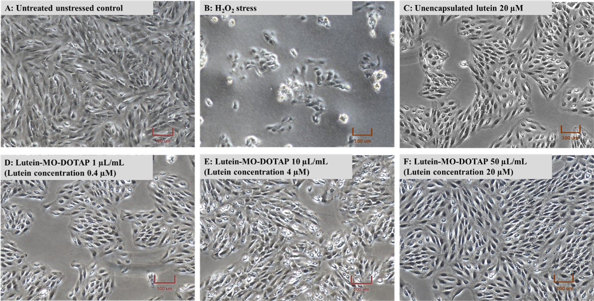 Morphology of lutein-pretreated RPE cells poststressed with H2O2. RPE cells were pretreated with 20 μM unencapsulated lutein or 1–50 μL/mL lutein-MO-DOTAP (containing 0.4–20 μM lutein) for 48 h prior to stress with 500 μM H2O2 for 12 h.