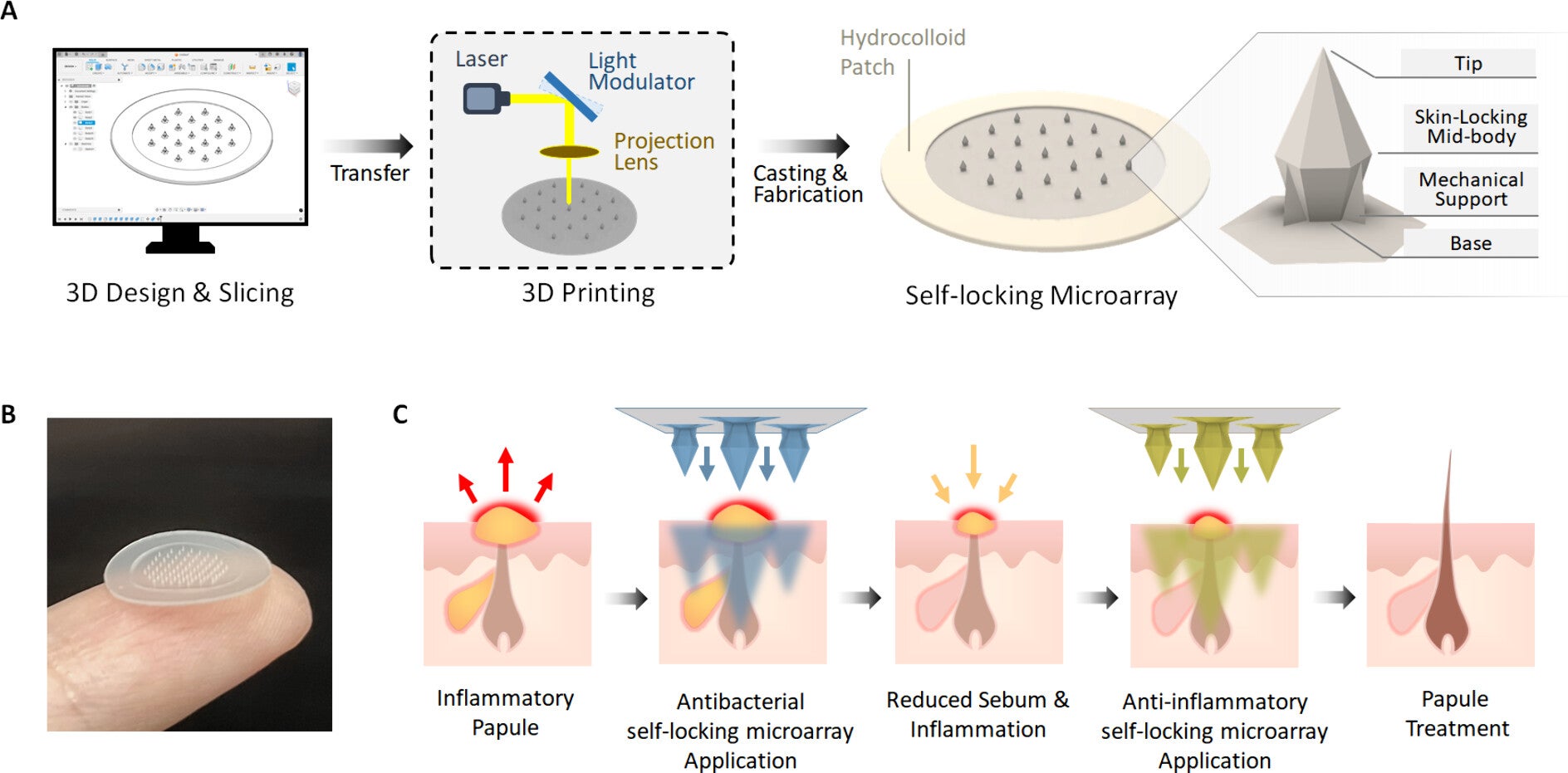Fabrication and therapeutic mechanism of self-locking microarray patches.
