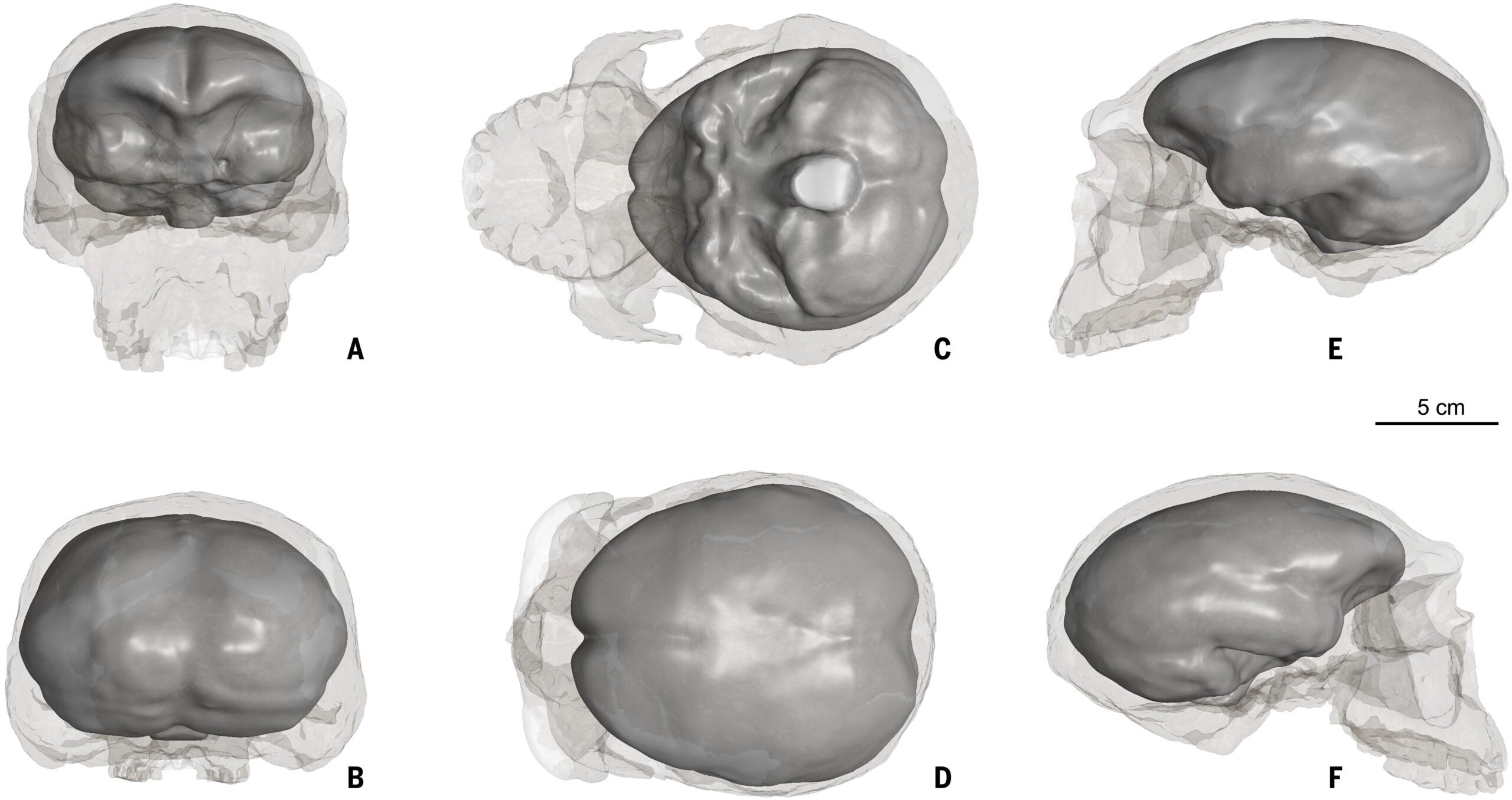 Reconstruction of the endocranial cast of Yunxian 2. (A to F) Anterior, posterior, inferior, superior, left, and right views, respectively.