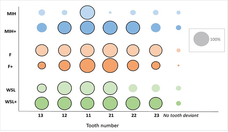 The size of the circles corresponds to the number of respondents who identified the tooth, from 13 to 23, as deviant with respect to color in the different cases of MIH (molar incisor hypomineralization), F (fluorosis), and WSL (white spot lesions). 