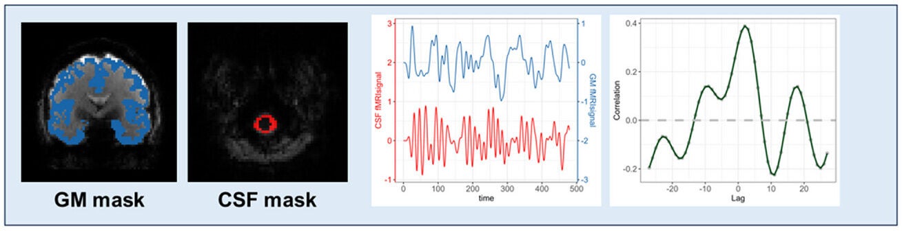 BOLD-CSF coupling evaluation by measuring the maximal cross-correlation between CSF signals (red trace) and BOLD signals (blue trace) in the cortex.