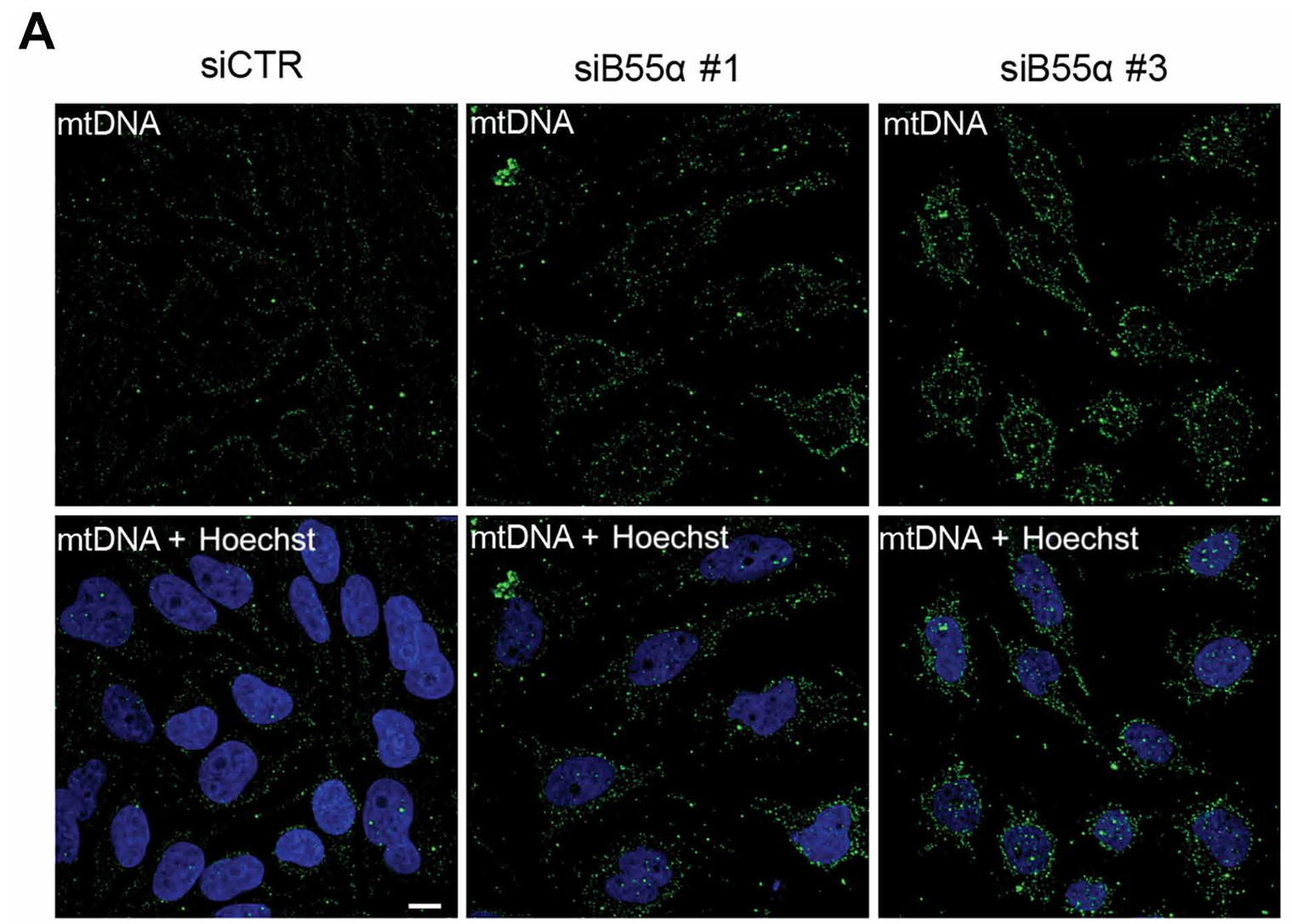 Parkin- induced hela cells depleted for B55α were stained for mtdnA and hoechst 33342. (B) Quantification of mtdnA/cell area ratio for cells as seen in (A).