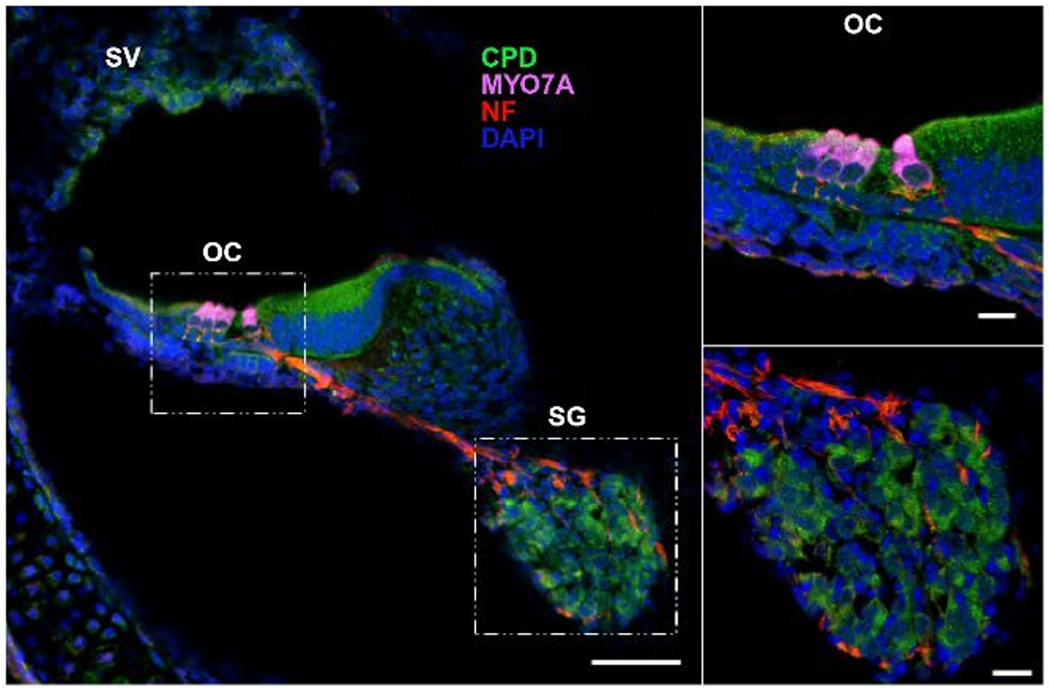 Localization of CPD in the mouse inner ear.