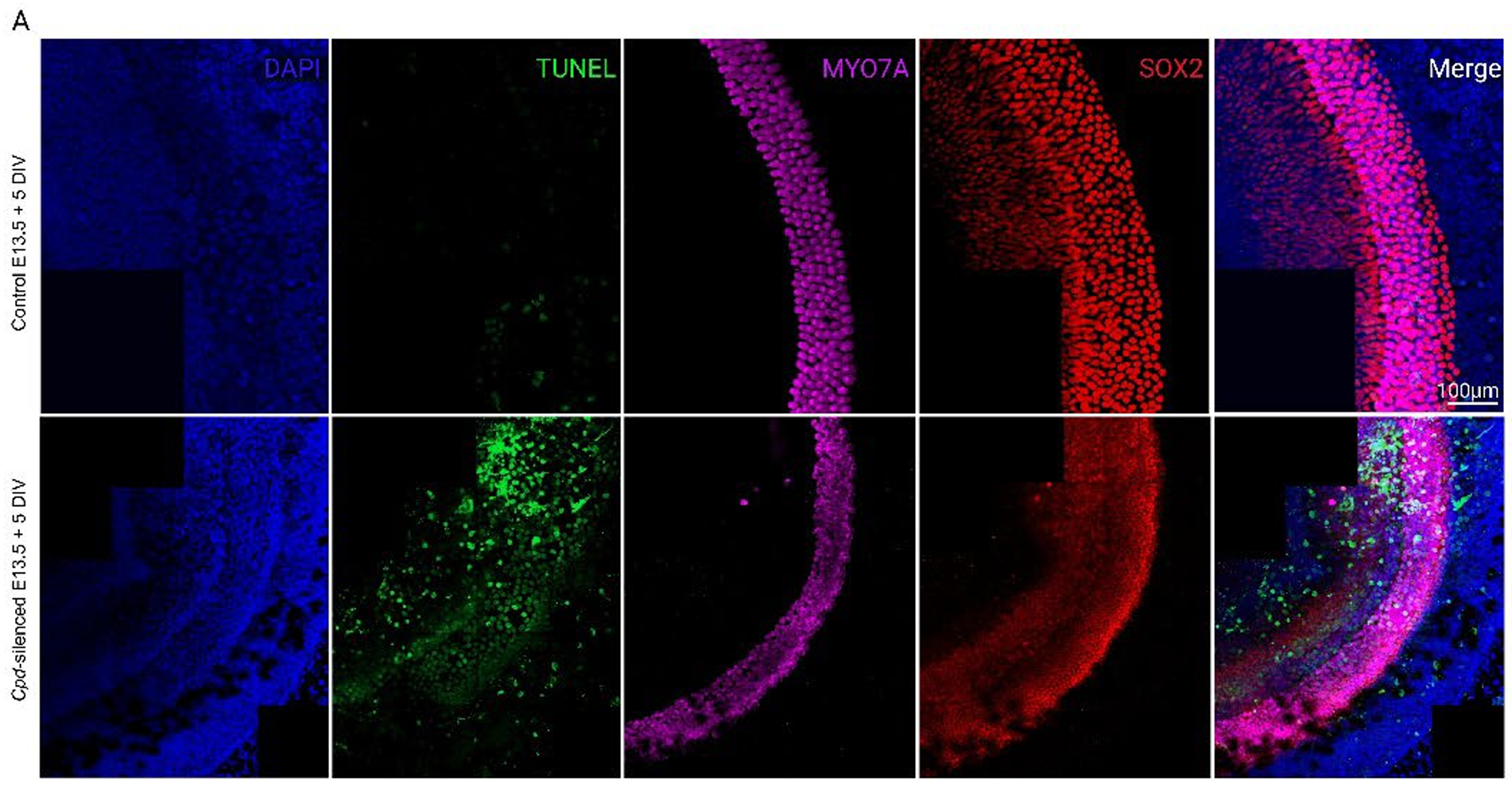 Representative confocal images of mouse cochlear explants (E13.5 + 5 DIV) showing increased apoptosis following Cpd silencing (infected at MOI-2×106), as indicated by TUNEL staining (green).