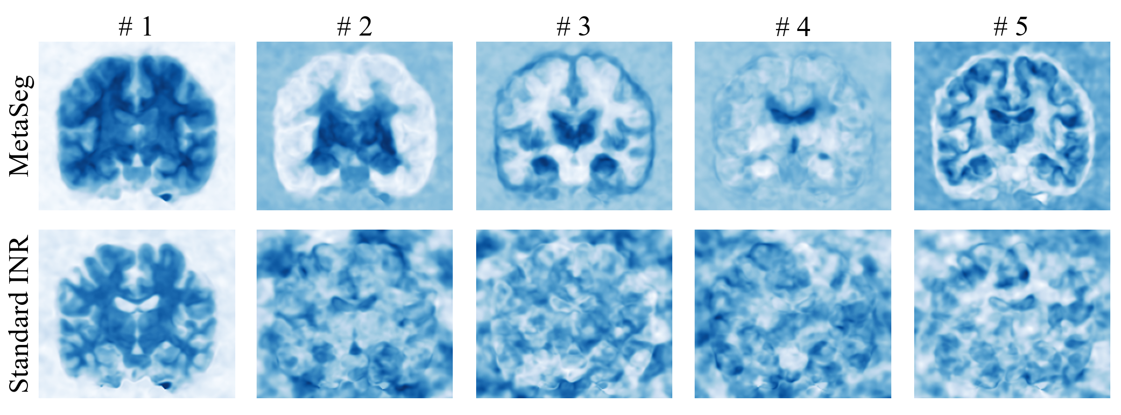 PCA visualization of penultimate features learned by MetaSeg and a standard INR for a 2D test scan.