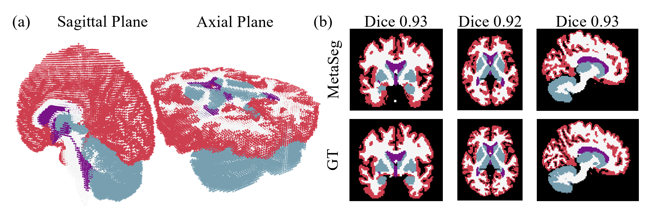 MetaSeg is capable of accurately segmenting 3D MRI volumes.
