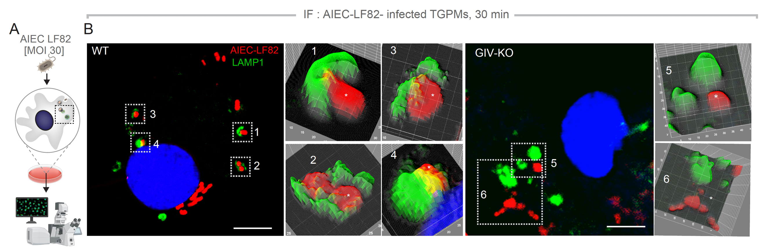 Workflow for immunofluorescence studies of AIEC-LF82-challenged TGPMs (A) and representative images (B) showing the proximity of AIEC-LF82 (red) to LAMP1-positive lysosomes (green). 