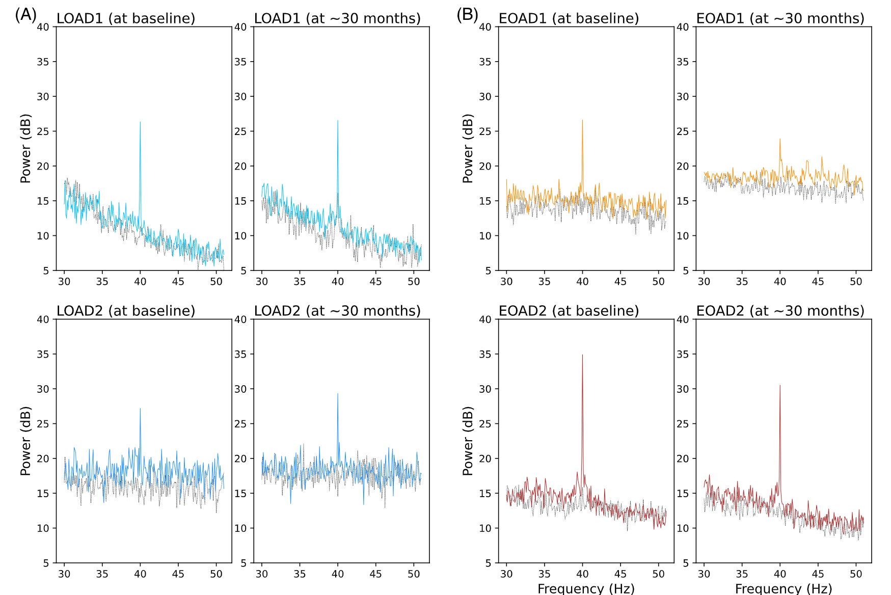 The 40 Hz power in response to GENUS. Power remains stable in late-onset AD subjects, but declines in early-onset AD subjects.