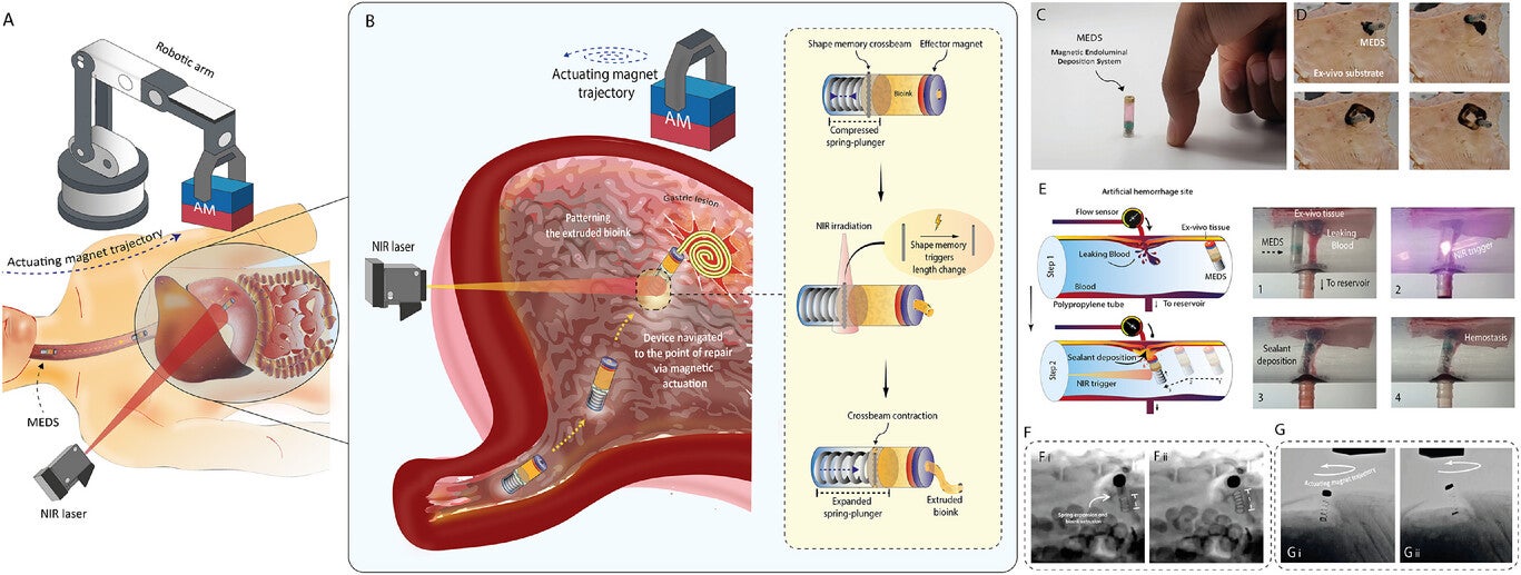 Overview of MEDS (Magnetic Endoluminal Deposition System) and its capabilities.