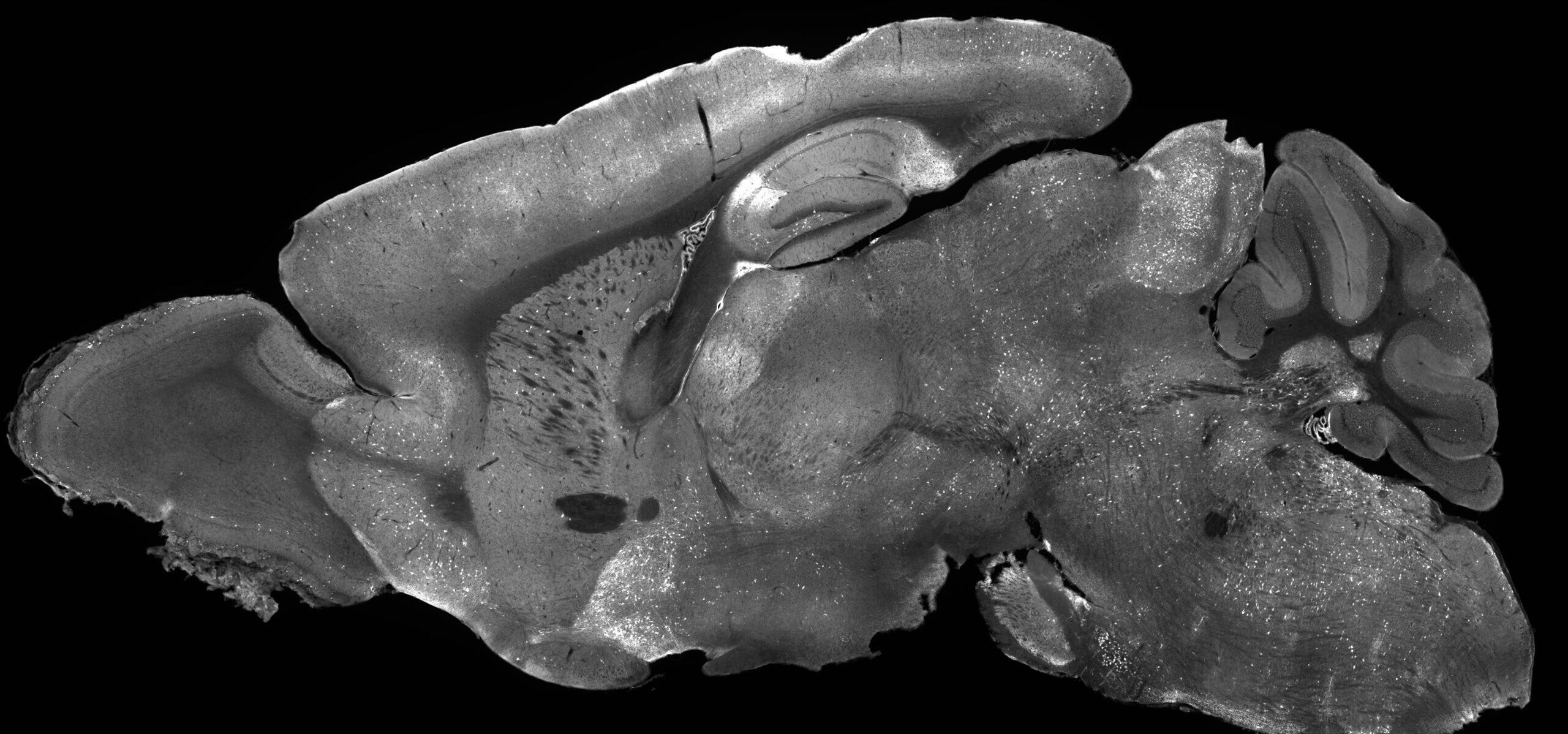 Mouse brain image glowing with experimental gene supplementation therapy highlighting how AAV delivers treatment across the entire brain.
