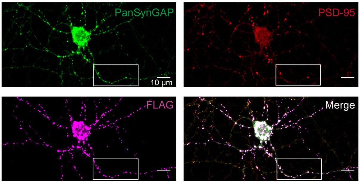 Rat neuronal cultures transfected with hSyn1-SYNGAP1-Aα1 shows FLAG tag (magenta) overlaps with PanSynGAP (green) detection.