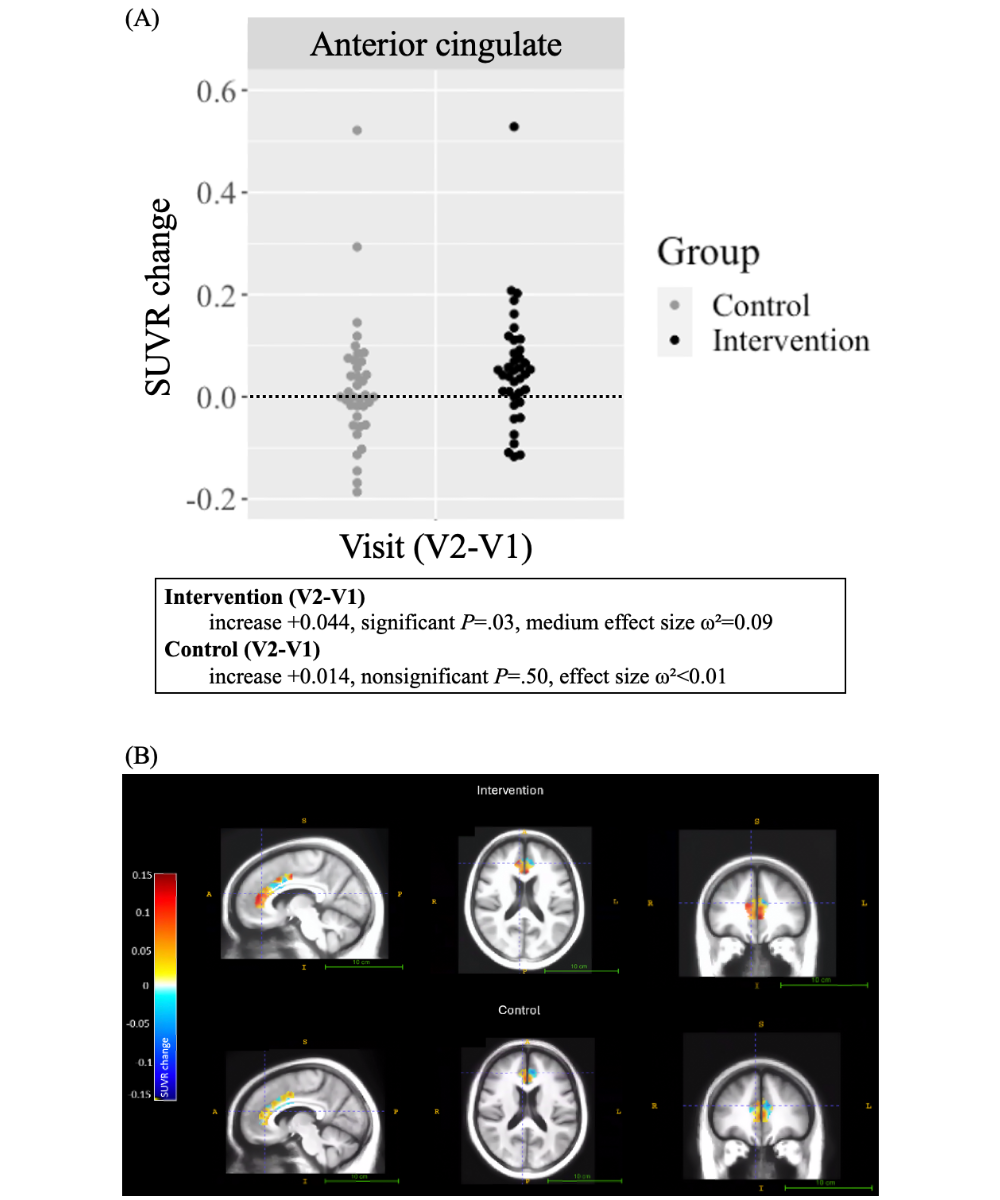 Standard uptake value ratio (SUVR) change within the primary region of interest (ROI).