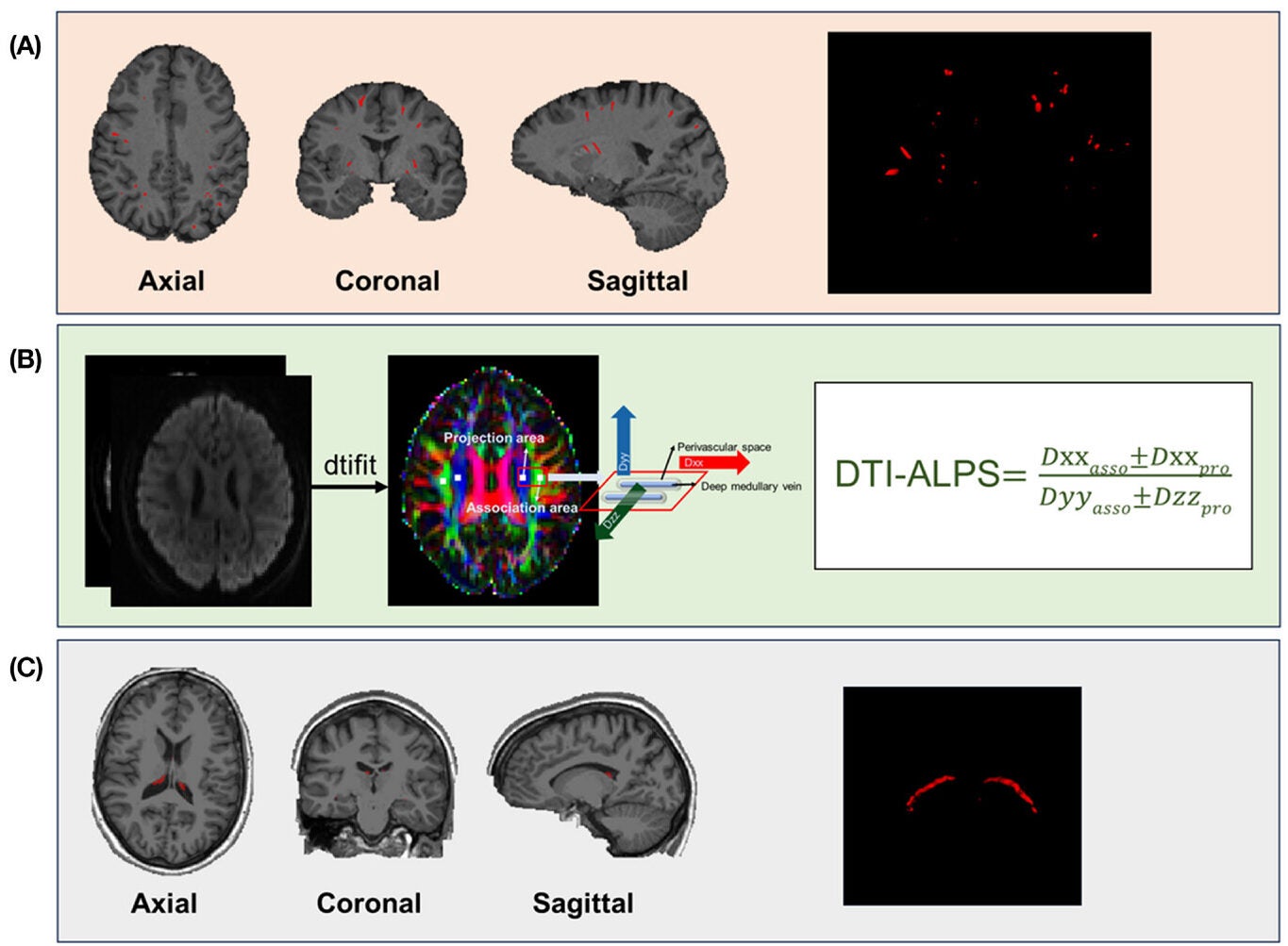The illustration of non-invasive MRI proxies of CSF dynamics markers.
