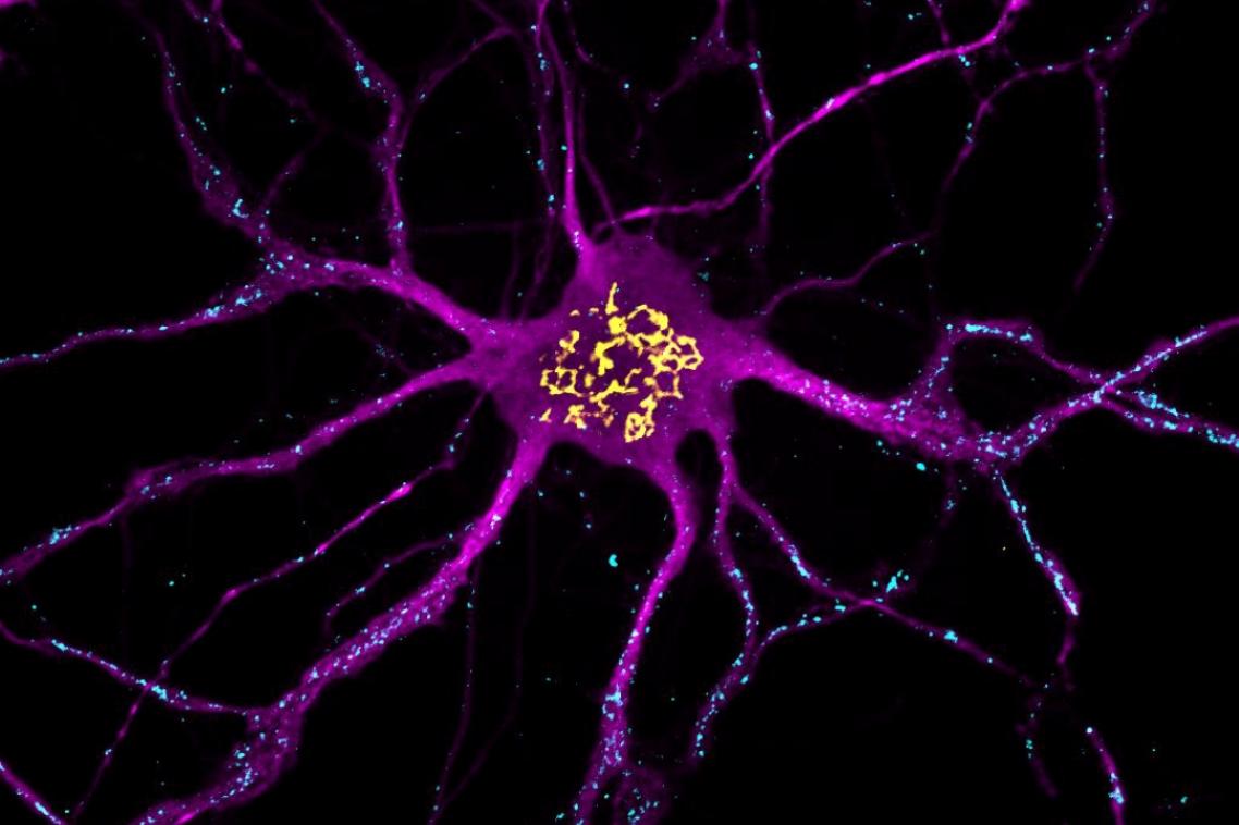 UQ researchers found that healthy neurons in the brain produce saturated fatty acids that they use for fuel.