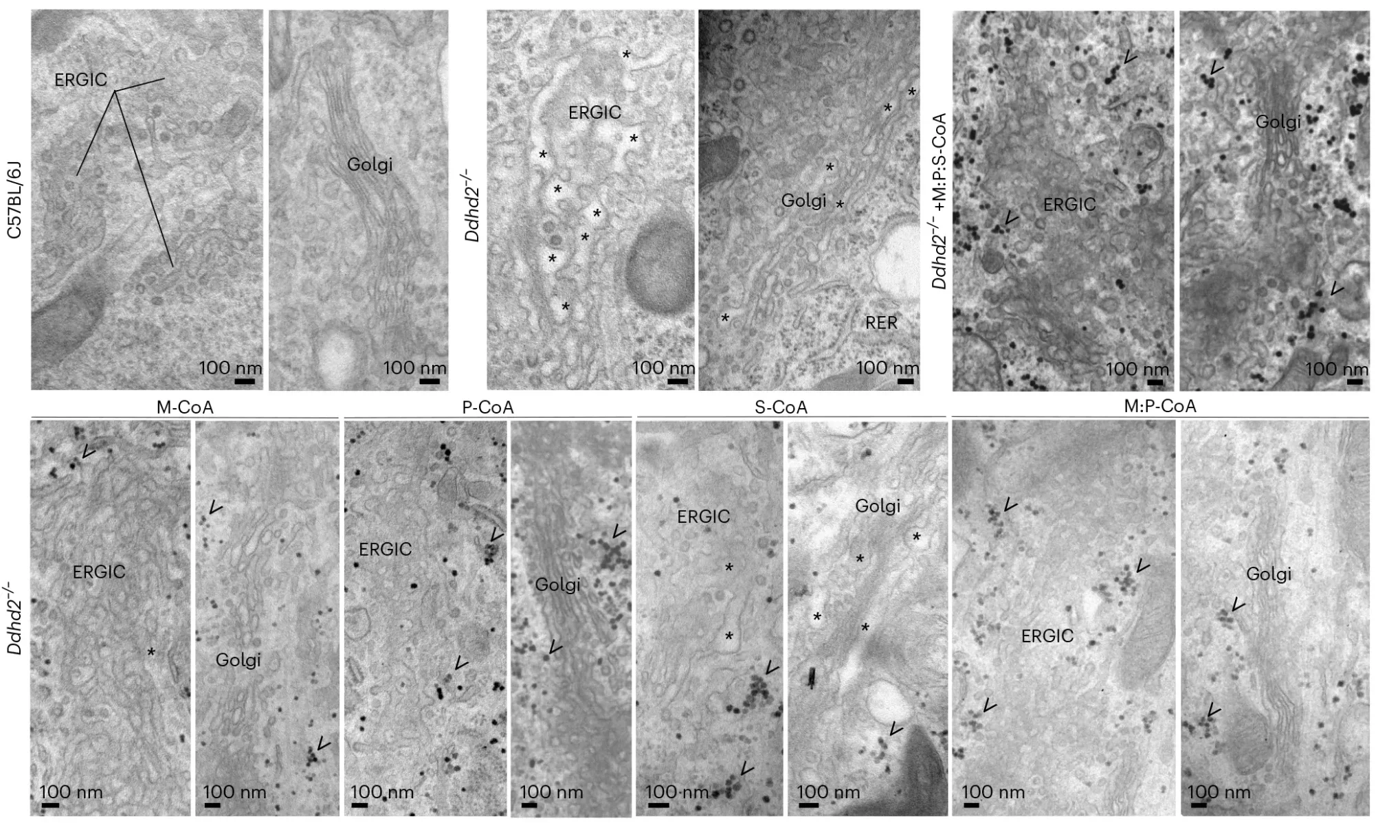 Loss of Ddhd2 alters the structure and membrane trafficking in the ERGIC and Golgi complex.