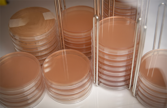 Agar plates used to grow bacteria from the human gastrointestinal tract
