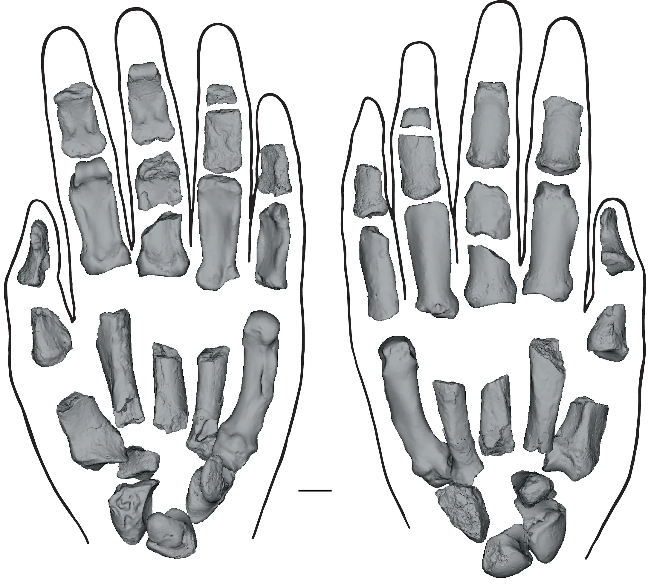 Reconstructed left hand of KNM-ER 101000. Palmar (left) and dorsal (right) views.