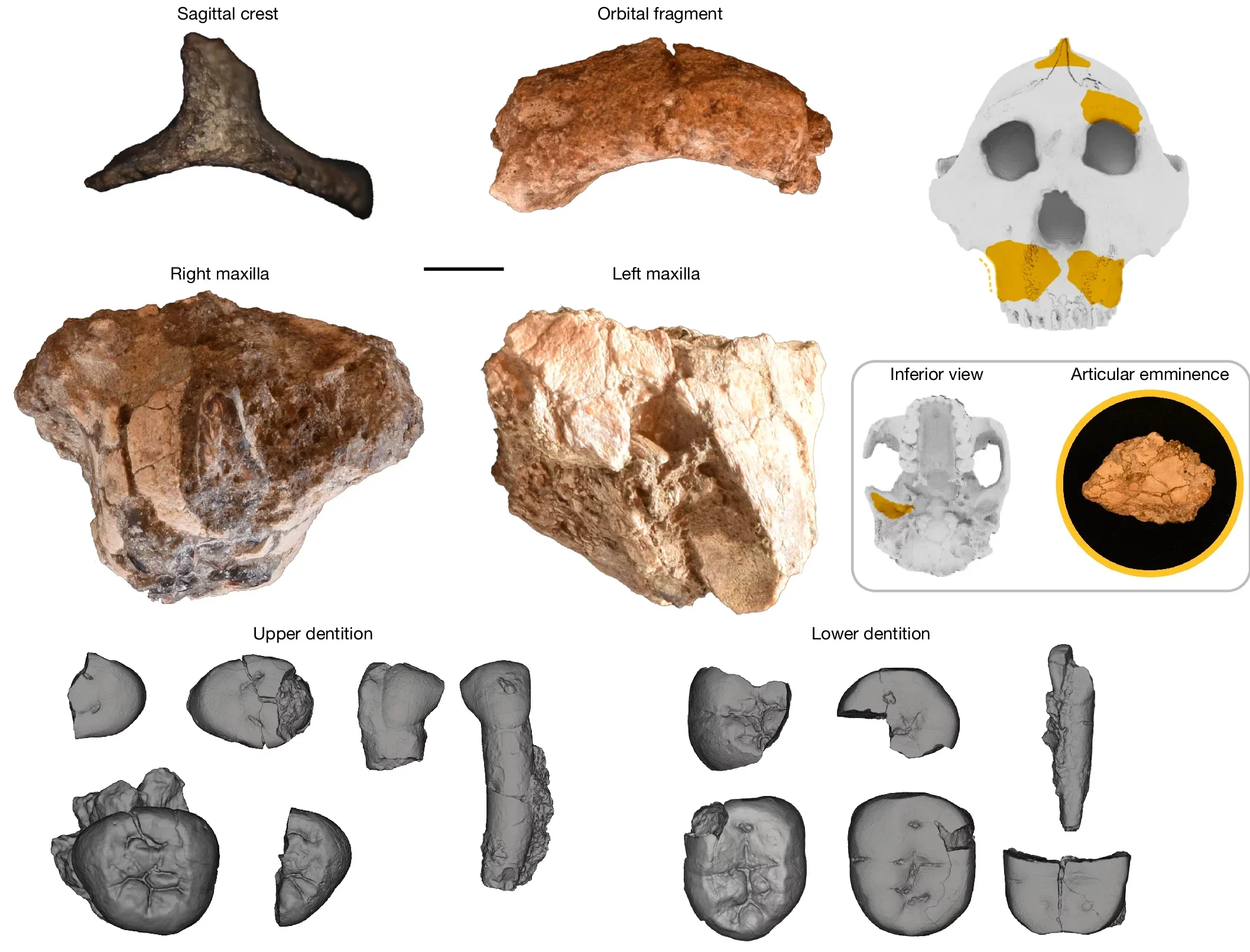 Diagnostic craniodental elements of KNM-ER 101000 shown in anatomical position against a silhouette of the reconstructed OH 5 cranium.