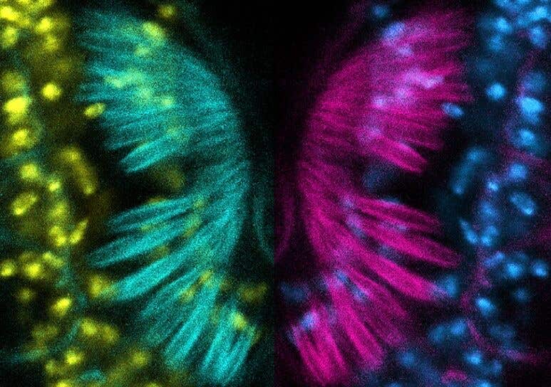Fruit fly models of deficiency in a gene called CPD show defects in Johnston’s organ (JO), a sensory organ on the antennae that helps sense gravity, wind flow, and near-field sound. This confocal micrographs image displays immunolabeled structures within the cilium of the JO.