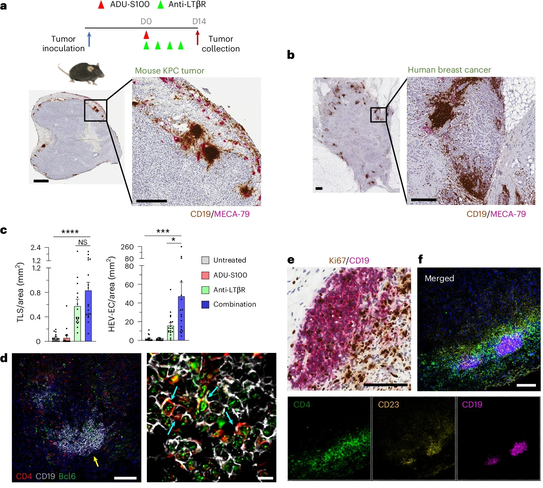 Drug induction of TLS and HEVs in subcutaneous tumors.