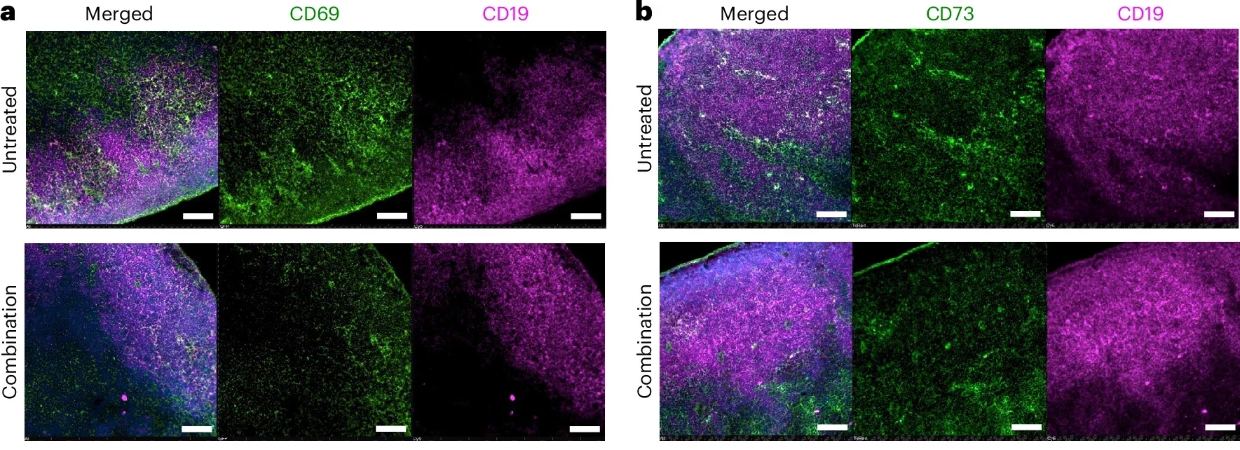 Germinal centers of tumor-draining lymph nodes.