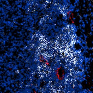A fluorescence image shows a tertiary lymphoid structure (TLS) inside a tumor, where B cells (white) form dense clusters surrounded by high endothelial venules (red)—specialized blood vessels that recruit B and T cells from circulation into the tumor to mount an immune response against cancer.