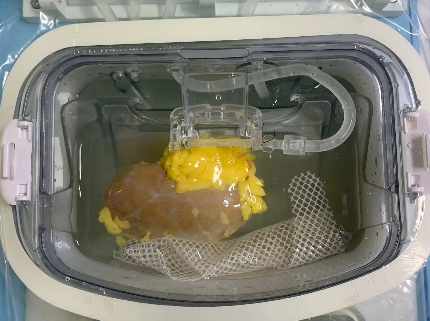 The kidney, pre-transplant, in a perfusion device which is used to circulate a solution that contains the converting enzymes.
