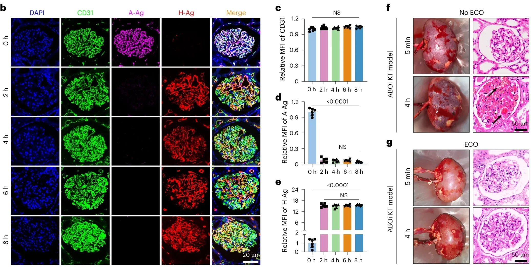 Enzymes removed A-Ag from human type-A1 kidneys by HMP and avoided antibody-mediated injury in the ABOi kidney transplant model.