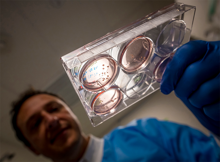 Alysson Muotri, Ph.D. with brain organoids. 