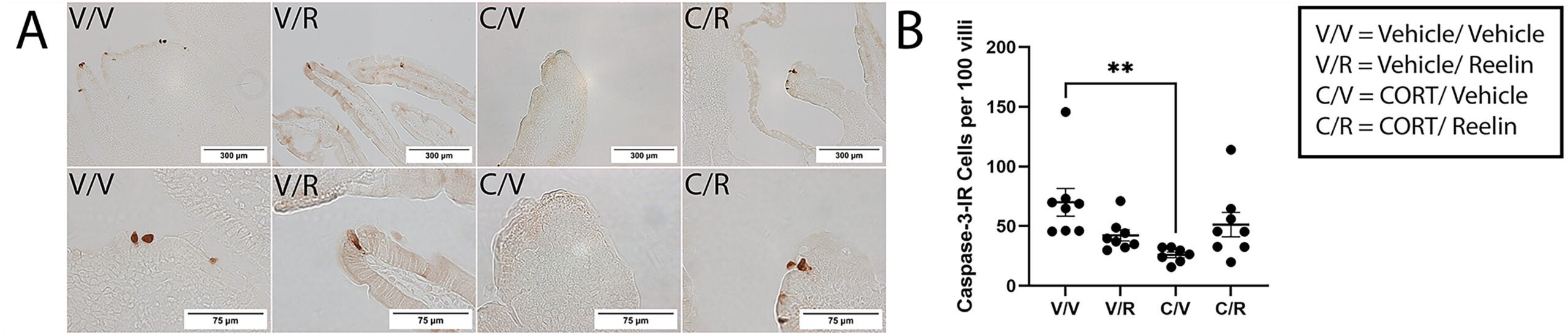 CORT Decreased Apoptotic Cells in the Upper Portion of Small Intestine Villi. Results are Expressed as the Number of Cleaved Caspase-3-IR Cells per 100 Villi.