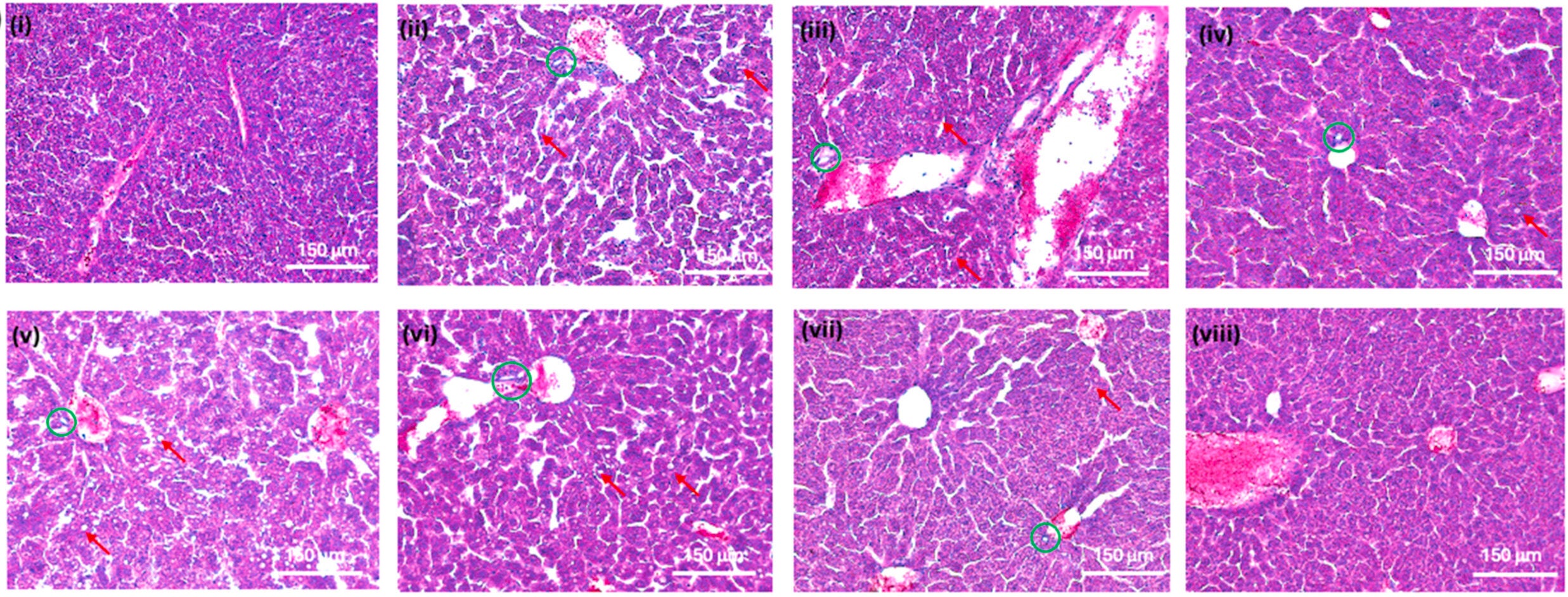H & E images of liver tissues after different treatments