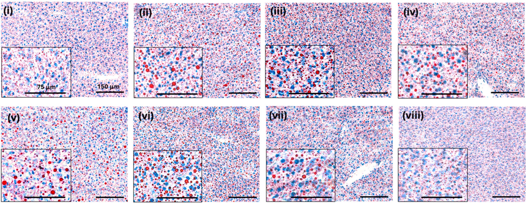 Oil red O images of cryopreserved liver tissues after 15 days of treatments.