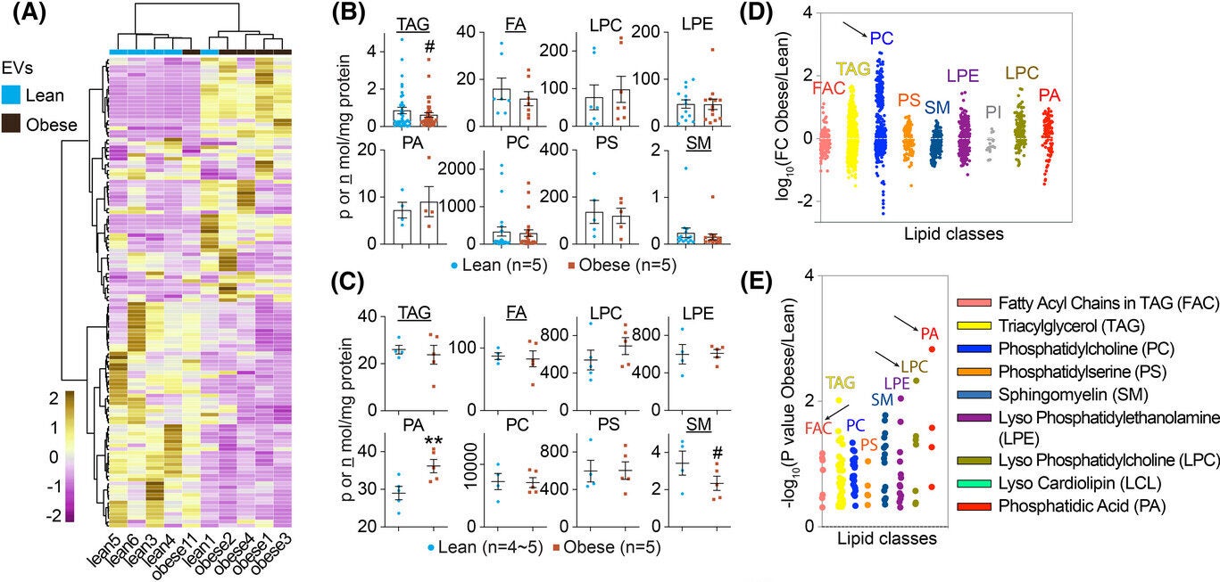 Lipidomic profiling of extracellular vesicles (EVs) from lean and obese individuals.