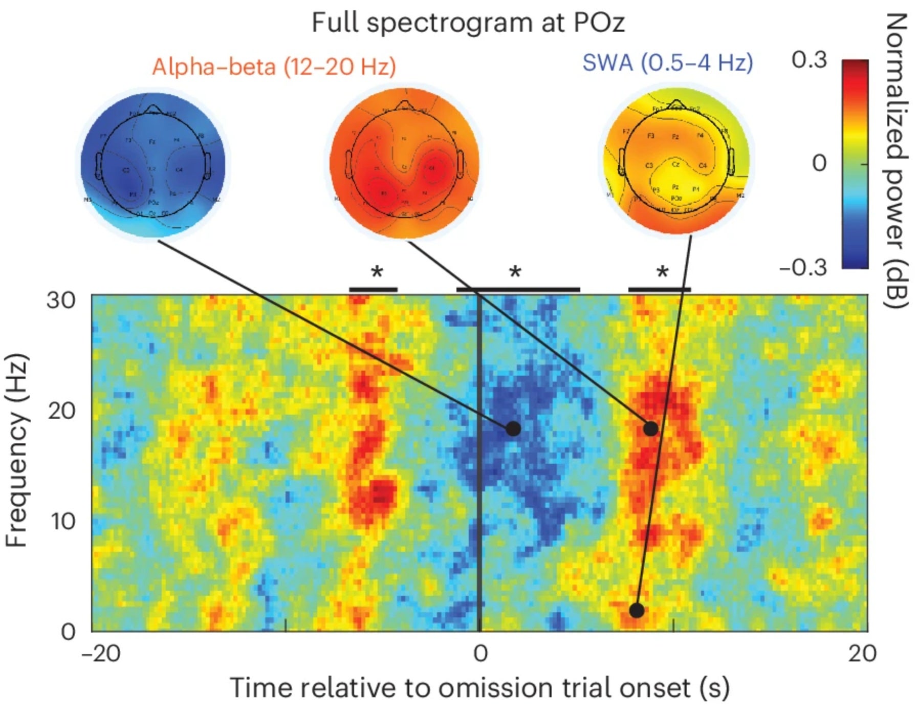 Attentional failures are coupled to pulsatile CSF flow and a series of neural and systemic physiological changes.