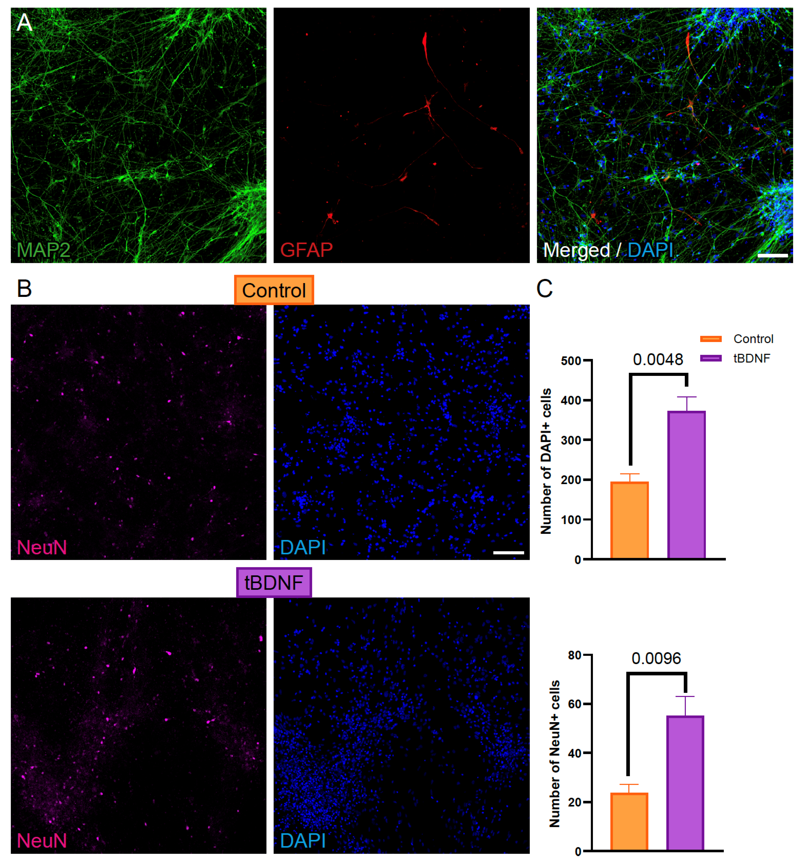 BDNF overexpression enhances neuronal differentiation of human iPSC-derived NPCs