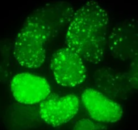 Scientists at Utrecht University created a gentle fluorescent sensor that tracks DNA damage and repair in living cells and animals, reshaping cancer and aging research.
