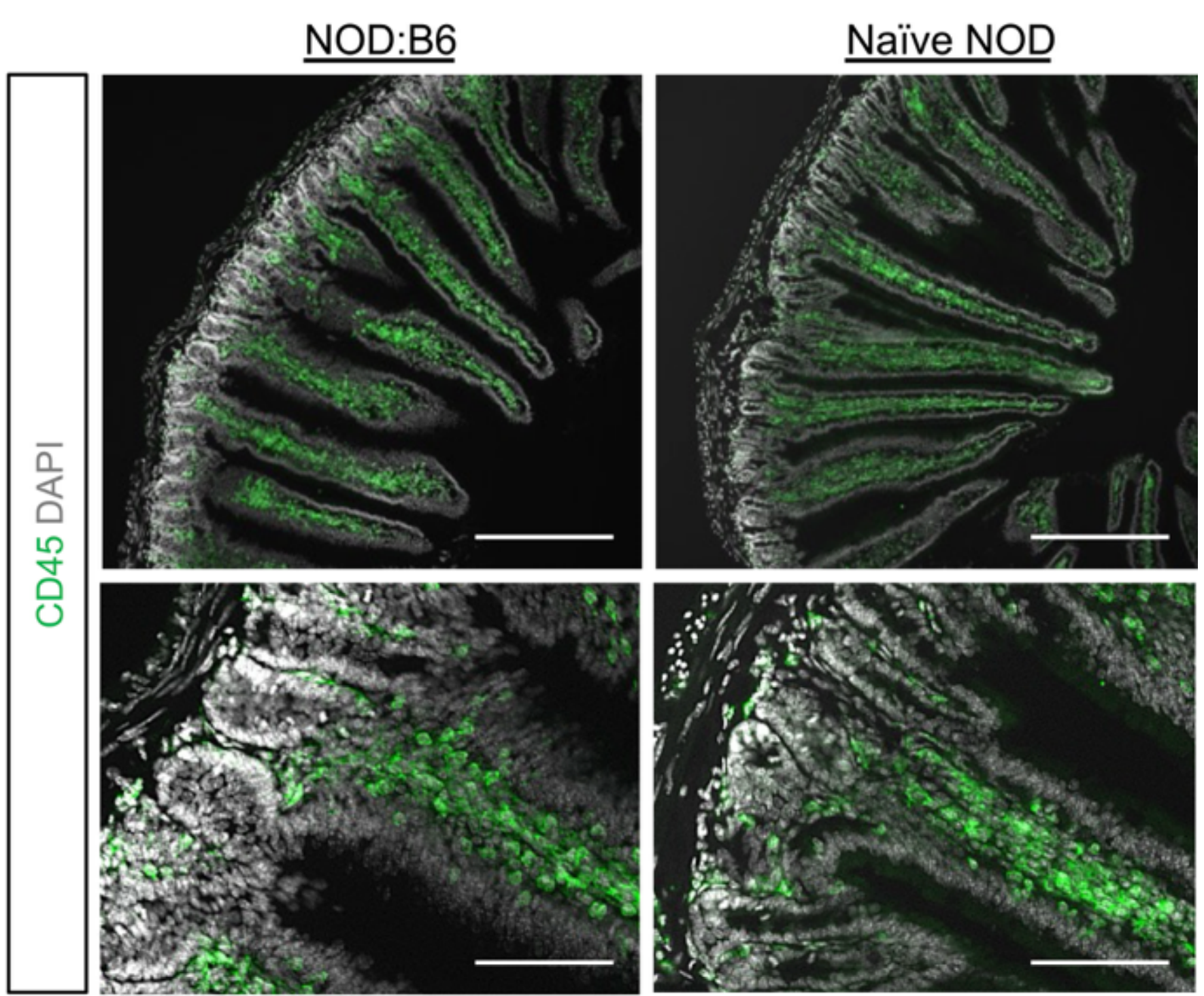 Representative host duodenal histology of prediabetic NOD:B6 chimeras (n = 14) at 20 weeks post-HCT compared to naïve NOD, stained for CD45.