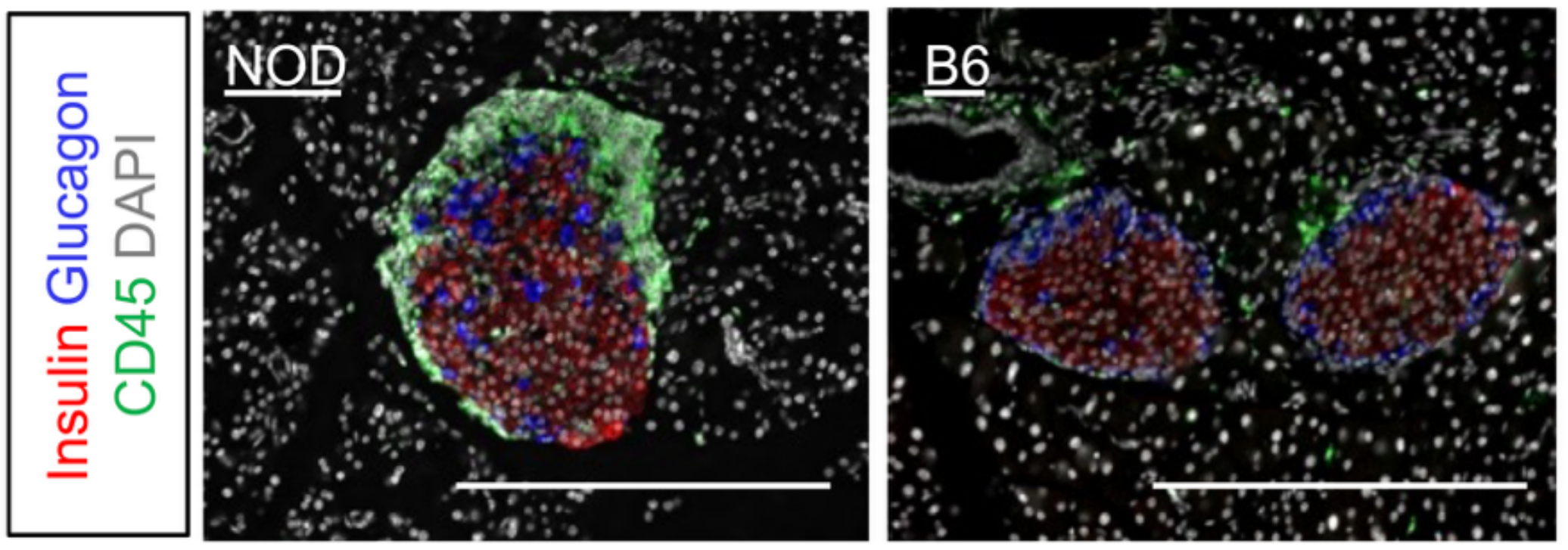 Representative pancreatic histology of prediabetic NOD at 8 weeks compared to naïve B6 after immunostaining for insulin, glucagon, and CD45. 