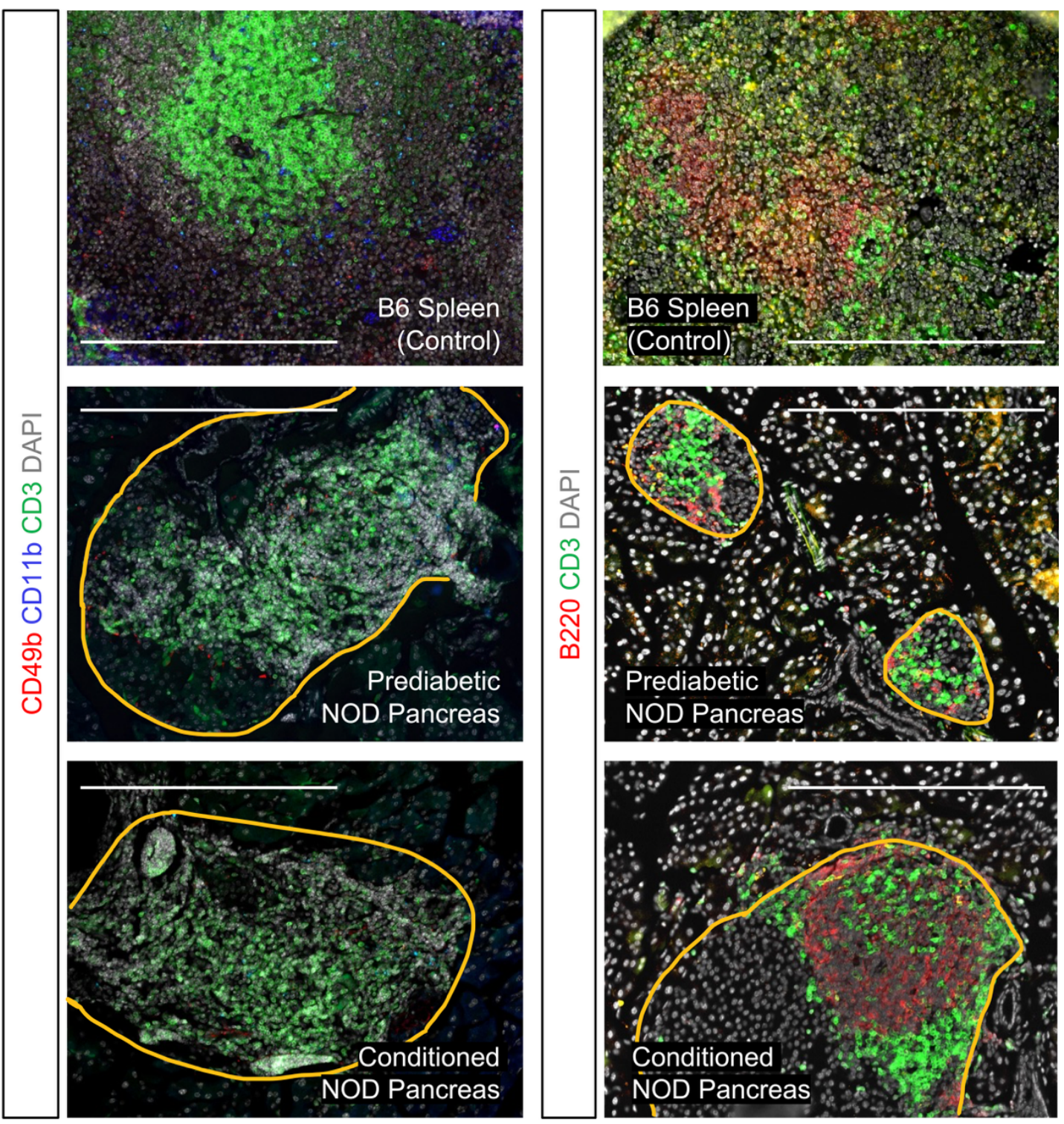 Representative pancreas histology of naïve prediabetic NOD at 12 weeks, or conditioned prediabetic NOD (20 weeks after conditioning), immunostained as indicated for CD3, CD49b and CD11b, or CD3 and B220. 